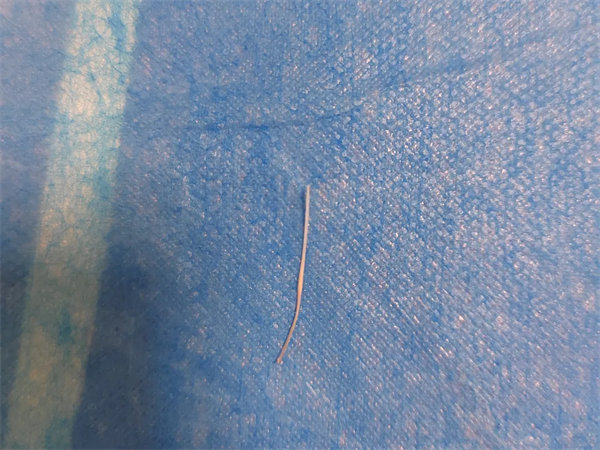 宝鸡第三医院-小鱼刺大危害!医生提醒您,“鱼刺卡喉”切勿擅自处理